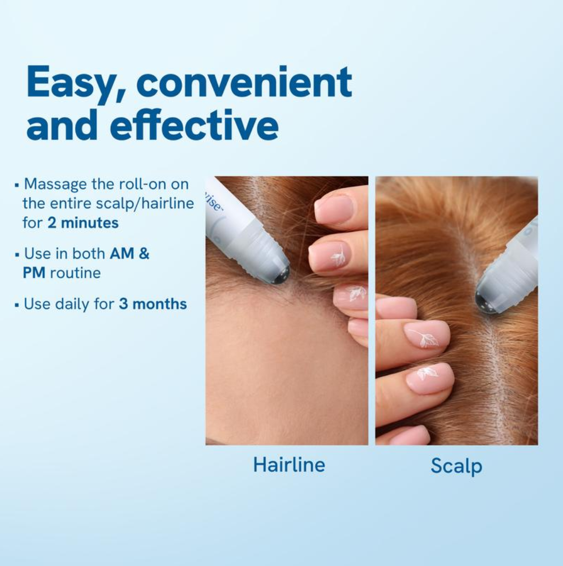 Be Bodywise Advanced Hair Growth Roll-On Serume